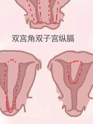 试管前查血沉，为啥？因为它悄悄影响你的，成功率