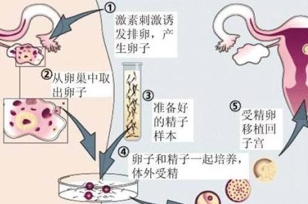 宫腔镜检查后多久可以做试管？宫腔镜是怎么做的？