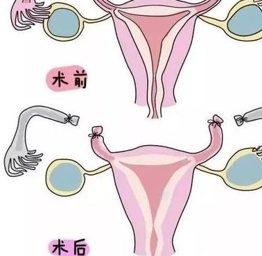2026年吉尔吉斯斯坦单身女性试管自助攻略有没有？三代试管流程
